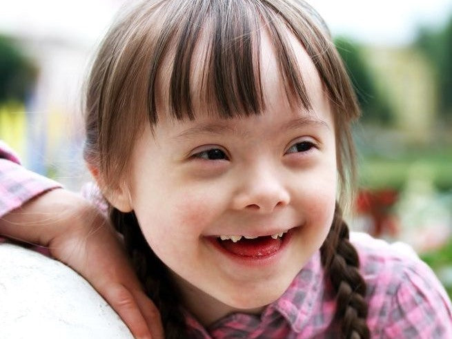 Smiling child with Down syndrome